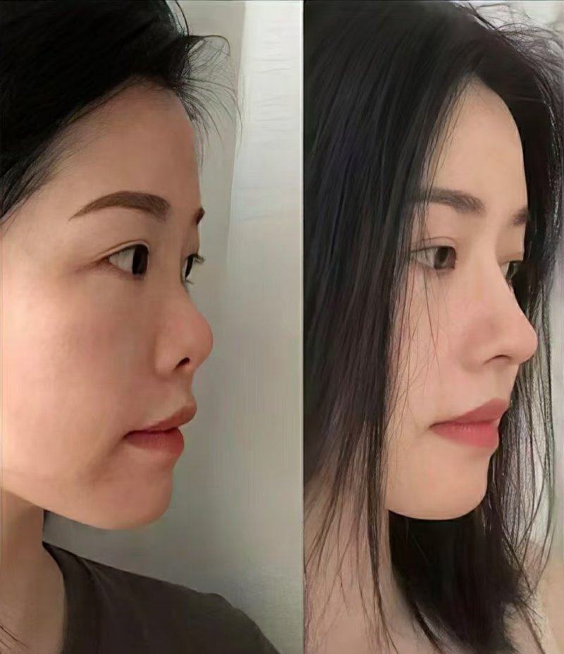 韩国A特整形外科医院真人口碑评价怎么样?