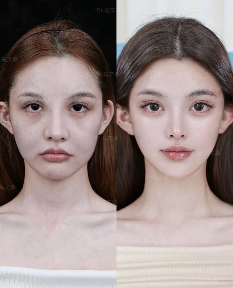 韩国A特整形外科医院收费价格表/收费标准