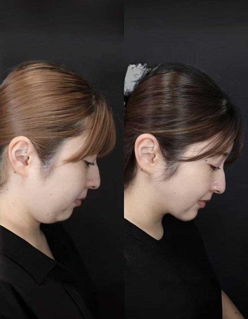 成都华 西整形医院真人口碑评价怎么样？