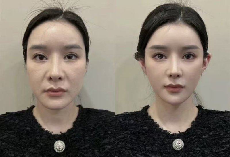 南京千秀美珏整形美容医院是正规医院吗？