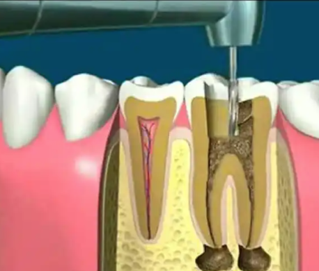 山东淄博淄川将军路孙岳口腔诊所详细的预约挂号方式及流程