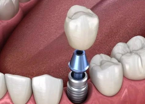 河南周口德正口腔医院地址电话营业时间