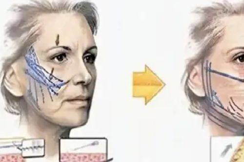 巴中巴州依韩尚美整形医院真人口碑评价怎么样？