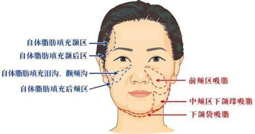 巴中巴州依韩尚美整形医院特色项目及技术优势