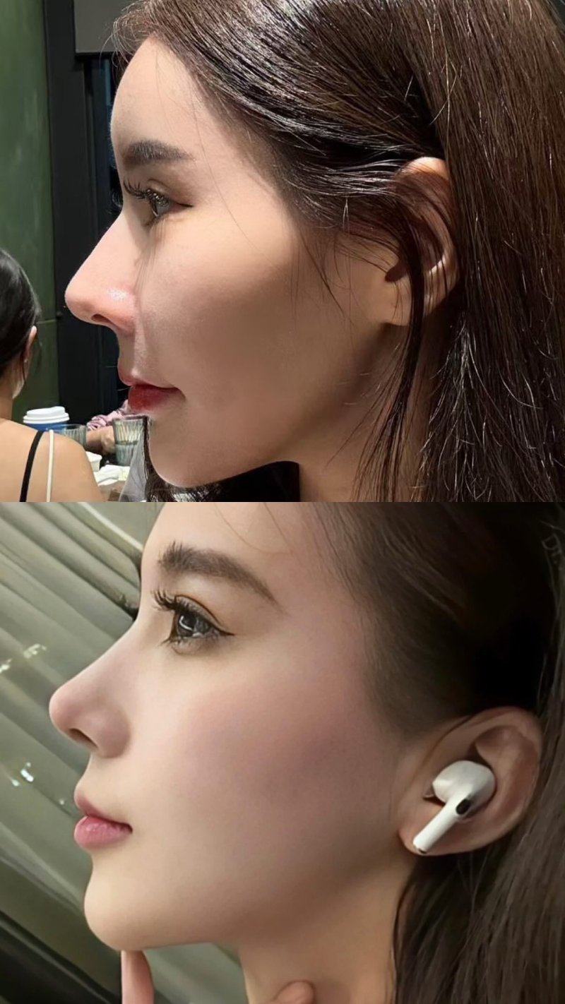 巴中巴州依韩尚美整形医院是正规医院吗？